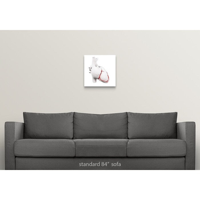 Coronary arteries, artwork - Multi