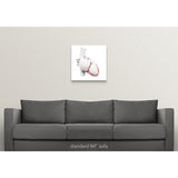 Coronary arteries, artwork - Multi