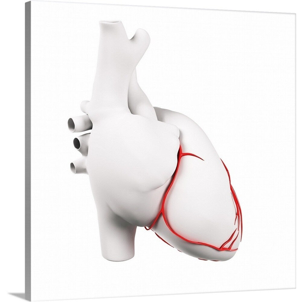 Coronary arteries, artwork - Multi