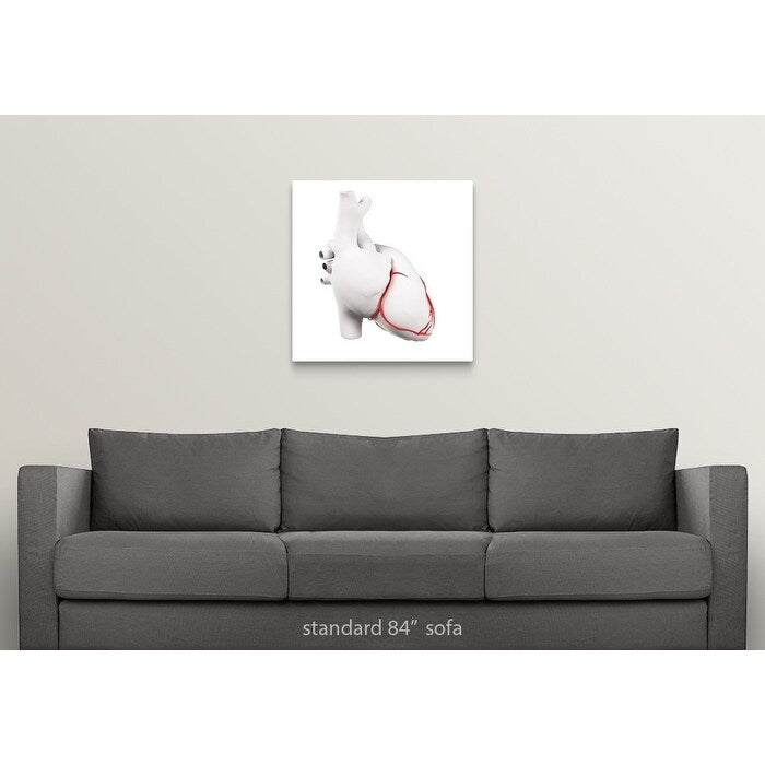Coronary arteries, artwork - Multi