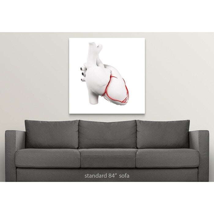 Coronary arteries, artwork - Multi
