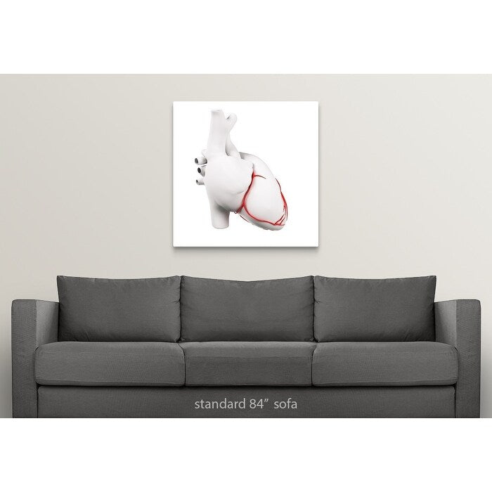 Coronary arteries, artwork - Multi