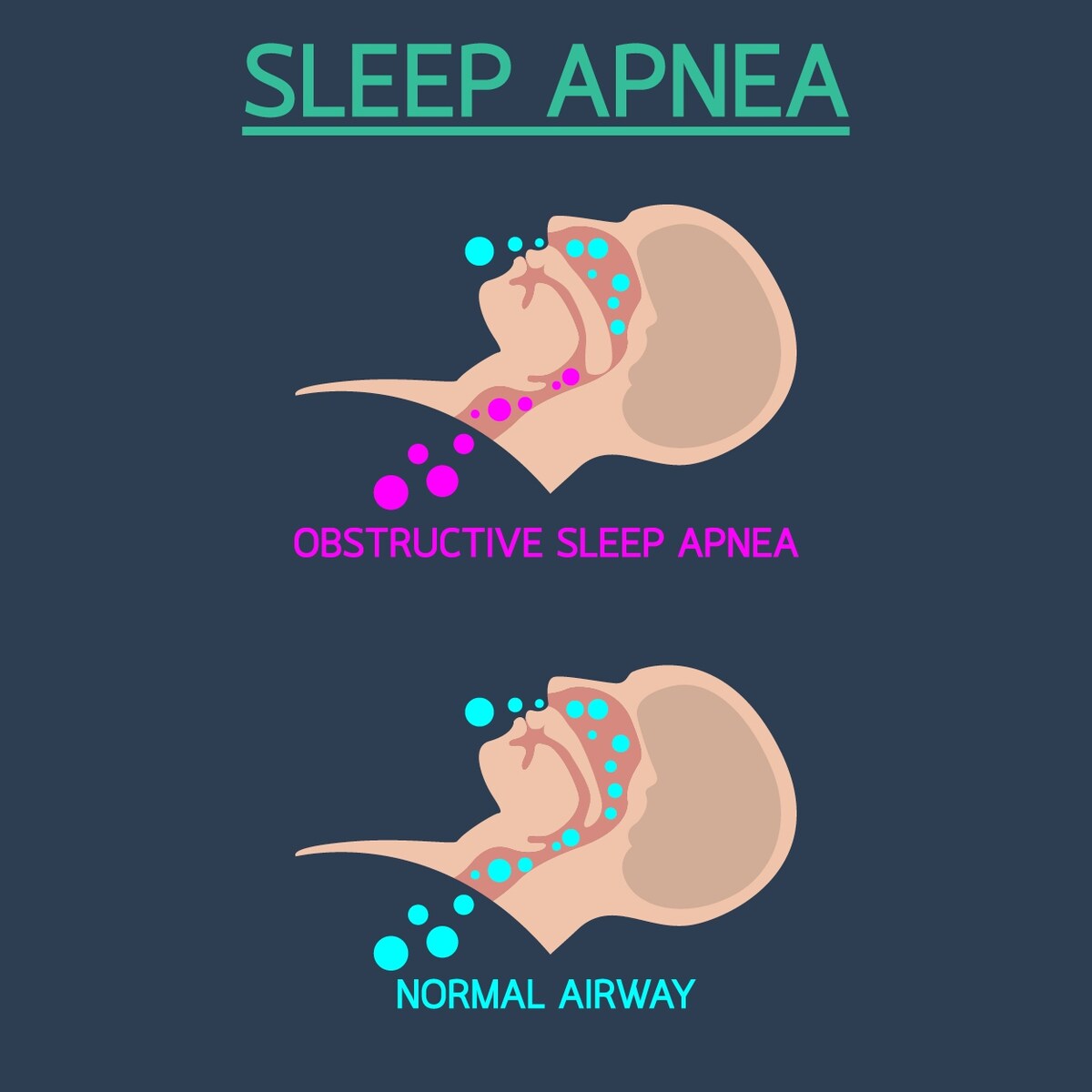 Science of Sleep SleePAP Pillow for CPAP Users - White